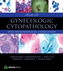 Atlas of Gynecologic Cytopathology : with Histopathologic Correlations - Book