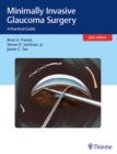 Minimally Invasive Glaucoma Surgery : A Practical Guide - Book