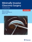 Minimally Invasive Glaucoma Surgery : A Practical Guide - eBook