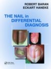 Nail in Differential Diagnosis - Book