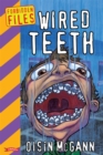 Wired Teeth - eBook