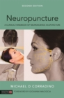 Neuropuncture : A Clinical Handbook of Neuroscience Acupuncture - Book