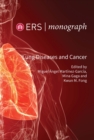Lung Diseases and Cancer - eBook