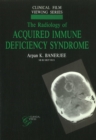 Radiology of Acquired Immune Deficiency Syndrome - Book