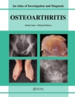 Oesteoarthritis : An Atlas of Investigation and Diagnosis - Book