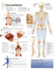 Osteoarthritis Paper Poster - Book