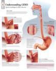 Understanding GERD (Gastroesophageal Reflux Disease) Laminated Poster - Book
