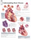 Understanding Heart Disease Laminated Poster - Book