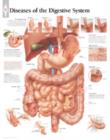 Diseases of the Digestive System Laminated Poster - Book