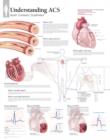 Understanding ACS (Acute Coronary Syndrome) Paper Poster - Book