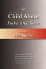 Child Abuse Pocket Atlas Series Volume 1 : Skin Injuries - eBook