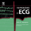 150 problemes d'ECG - eBook