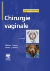 Chirurgie vaginale - eBook
