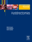 Hysterectomies - eBook