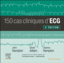 150 cas cliniques d'ECG - eBook