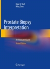 Prostate Biopsy Interpretation : An Illustrated Guide - Book