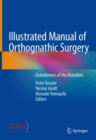 Illustrated Manual of Orthognathic Surgery : Osteotomies of the Mandible - Book