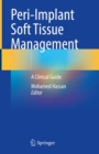 Peri-Implant Soft Tissue Management : A Clinical Guide - eBook