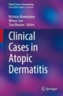 Clinical Cases in Atopic Dermatitis - eBook