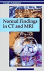 Normal Findings in CT and MRI, A1, print - Book