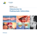 Osteotomies for Posttraumatic Deformities - Book
