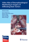 Video Atlas of Neurophysiological Monitoring in Surgery of Infiltrating Brain Tumors - Book
