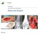 AO Manual of Fracture Management - Elbow and Forearm - eBook