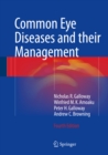 Common Eye Diseases and their Management - eBook
