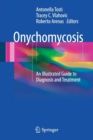 Onychomycosis : An Illustrated Guide to Diagnosis and Treatment - Book