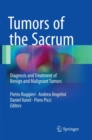 Tumors of the Sacrum : Diagnosis and Treatment of Benign and Malignant Tumors - Book
