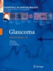 Glaucoma - eBook