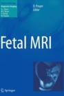 Fetal MRI - Book