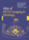 Atlas of PET/CT Imaging in Oncology - eBook
