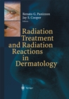 Radiation Treatment and Radiation Reactions in Dermatology - eBook