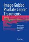 Image Guided Prostate Cancer Treatments - eBook