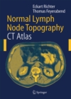 Normal Lymph Node Topography : CT Atlas - eBook