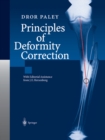 Principles of Deformity Correction - eBook