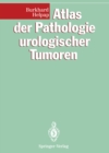 Atlas der Pathologie urologischer Tumoren - eBook