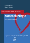 Aortenchirurgie : Ein Patientenratgeber - eBook