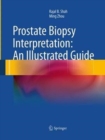 Prostate Biopsy Interpretation: An Illustrated Guide - Book