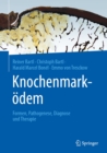 Knochenmarkodem : Formen, Pathogenese, Diagnose und Therapie - eBook