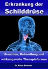 Erkrankung der Schilddruse - Ursachen, Behandlung und wirkungsvolle Therapieformen - eBook