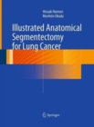 Illustrated Anatomical Segmentectomy for Lung Cancer - Book