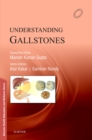 Understanding Gallstones - E-Book - eBook