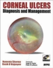 Corneal Ulcers Diagnosis and Management - Book