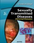 Sexually Transmitted Diseases (Venereal Diseases) - Book