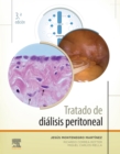 Tratado de dialisis peritoneal - eBook