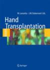 Hand transplantation - Book