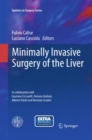 Minimally Invasive Surgery of the Liver - eBook