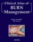Clinical Atlas of Burn Managment - Book